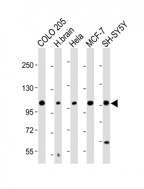 Kv10.1 / KCNH1 Antibody - All lanes: Anti-KCNH1 Antibody (C-Term) at 1:2000 dilution Lane 1: COLO 205 whole cell lysate Lane 2: Human brain lysate Lane 3: Hela whole cell lysate Lane 4: MCF-7 whole cell lysate Lane 5: SH-SY5Y whole cell lysate Lysates/proteins at 20 µg per lane. Secondary Goat Anti-Rabbit IgG, (H+L), Peroxidase conjugated at 1/10000 dilution. Predicted band size: 111 kDa Blocking/Dilution buffer: 5% NFDM/TBST.