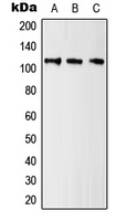Kv10.1 / KCNH1 Antibody - Western blot analysis of Kv10.1 expression in HeLa (A); NIH3T3 (B); H9C2 (C) whole cell lysates.