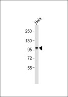 Kv10.1 / KCNH1 Antibody - Anti-Kv10.1 Antibody at 1:1000 dilution + HeLa whole cell lysates Lysates/proteins at 20 ug per lane. Secondary Goat Anti-Rabbit IgG, (H+L),Peroxidase conjugated at 1/10000 dilution Predicted band size : 111 kDa Blocking/Dilution buffer: 5% NFDM/TBST.