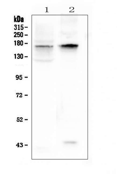 Kv10.1 / KCNH1 Antibody - Western blot analysis of KCNH1 using anti-KCNH1 antibody. Electrophoresis was performed on a 5-20% SDS-PAGE gel at 70V (Stacking gel) / 90V (Resolving gel) for 2-3 hours. The sample well of each lane was loaded with 50ug of sample under reducing conditions. Lane 1: rat brain tissue lysates,Lane 2: mouse brain tissue lysates. After Electrophoresis, proteins were transferred to a Nitrocellulose membrane at 150mA for 50-90 minutes. Blocked the membrane with 5% Non-fat Milk/ TBS for 1.5 hour at RT. The membrane was incubated with rabbit anti-KCNH1 antigen affinity purified polyclonal antibody at 0.5 µg/mL overnight at 4°C, then washed with TBS-0.1% Tween 3 times with 5 minutes each and probed with a goat anti-rabbit IgG-HRP secondary antibody at a dilution of 1:10000 for 1.5 hour at RT. The signal is developed using an Enhanced Chemiluminescent detection (ECL) kit with Tanon 5200 system. A specific band was detected for KCNH1 at approximately 160KD. The expected band size for KCNH1 is at 111KD.