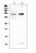 Kv10.1 / KCNH1 Antibody - Western blot analysis of KCNH1 using anti-KCNH1 antibody. Electrophoresis was performed on a 5-20% SDS-PAGE gel at 70V (Stacking gel) / 90V (Resolving gel) for 2-3 hours. The sample well of each lane was loaded with 50ug of sample under reducing conditions. Lane 1: rat brain tissue lysates,Lane 2: mouse brain tissue lysates. After Electrophoresis, proteins were transferred to a Nitrocellulose membrane at 150mA for 50-90 minutes. Blocked the membrane with 5% Non-fat Milk/ TBS for 1.5 hour at RT. The membrane was incubated with rabbit anti-KCNH1 antigen affinity purified polyclonal antibody at 0.5 µg/mL overnight at 4°C, then washed with TBS-0.1% Tween 3 times with 5 minutes each and probed with a goat anti-rabbit IgG-HRP secondary antibody at a dilution of 1:10000 for 1.5 hour at RT. The signal is developed using an Enhanced Chemiluminescent detection (ECL) kit with Tanon 5200 system. A specific band was detected for KCNH1 at approximately 160KD. The expected band size for KCNH1 is at 111KD.