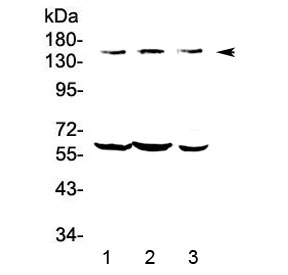 Kv10.1 / KCNH1 Antibody - Western blot testing of human 1) COLO-320, 2) HepG2 and 3) A549 lysate with KCNH1 antibody at 0.5ug/ml. Predicted molecular weight ~111 kDa (may be observed larger than predicted due to glycosylation).