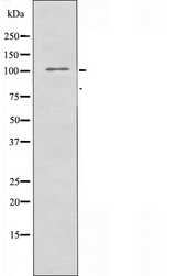 Kv10.1 / KCNH1 Antibody - Western blot analysis of extracts of HuvEc cells using KCNH1 antibody.