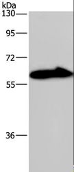 KV6.4 / KCNG4 Antibody - Western blot analysis of Mouse brain tissue, using KCNG4 Polyclonal Antibody at dilution of 1:550.