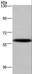 KV6.4 / KCNG4 Antibody - Western blot analysis of Mouse brain tissue, using KCNG4 Polyclonal Antibody at dilution of 1:500.