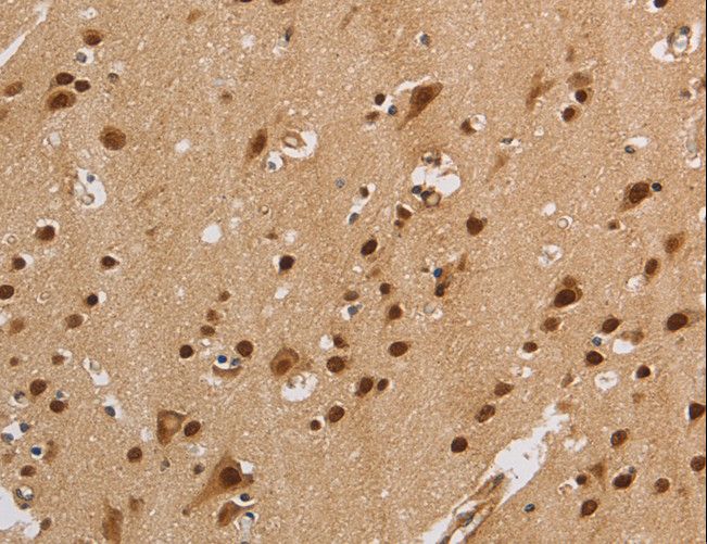 KV6.4 / KCNG4 Antibody - Immunohistochemistry of paraffin-embedded Human brain using KCNG4 Polyclonal Antibody at dilution of 1:40.