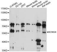 KV6.4 / KCNG4 Antibody - Western blot analysis of extracts of various cell lines, using KCNG4 antibody at 1:3000 dilution. The secondary antibody used was an HRP Goat Anti-Rabbit IgG (H+L) at 1:10000 dilution. Lysates were loaded 25ug per lane and 3% nonfat dry milk in TBST was used for blocking. An ECL Kit was used for detection and the exposure time was 60s.