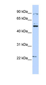 KX / XK Antibody - XK antibody Western blot of HeLa lysate. This image was taken for the unconjugated form of this product. Other forms have not been tested.