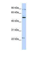 KX / XK Antibody - XK antibody Western blot of HeLa lysate. This image was taken for the unconjugated form of this product. Other forms have not been tested.