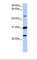 KX / XK Antibody - MCF7 cell lysate. Antibody concentration: 1.0 ug/ml. Gel concentration: 12%.  This image was taken for the unconjugated form of this product. Other forms have not been tested.