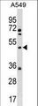 KX / XK Antibody - XK Antibody western blot of A549 cell line lysates (35 ug/lane). The XK antibody detected the XK protein (arrow).