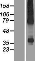 KX / XK Protein - Western validation with an anti-DDK antibody * L: Control HEK293 lysate R: Over-expression lysate