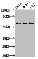 KY Antibody - Positive Western Blot detected in Hela whole cell lysate, MCF-7 whole cell lysate, U87 whole cell lysate. All lanes: KY antibody at 3.2 µg/ml Secondary Goat polyclonal to rabbit IgG at 1/50000 dilution. Predicted band size: 64, 42, 73, 76 KDa. Observed band size: 64 KDa
