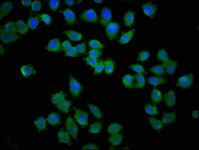 KY Antibody - Immunofluorescence staining of Hela cells with KY Antibody at 1:133, counter-stained with DAPI. The cells were fixed in 4% formaldehyde, permeabilized using 0.2% Triton X-100 and blocked in 10% normal Goat Serum. The cells were then incubated with the antibody overnight at 4°C. The secondary antibody was Alexa Fluor 488-congugated AffiniPure Goat Anti-Rabbit IgG(H+L).