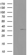 KYNU Antibody - HEK293T cells were transfected with the pCMV6-ENTRY control (Left lane) or pCMV6-ENTRY KYNU (Right lane) cDNA for 48 hrs and lysed. Equivalent amounts of cell lysates (5 ug per lane) were separated by SDS-PAGE and immunoblotted with anti-KYNU.