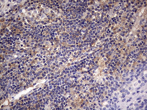 KYNU Antibody - IHC of paraffin-embedded Human lymph node tissue using anti-KYNU mouse monoclonal antibody. (heat-induced epitope retrieval by 1 mM EDTA in 10mM Tris, pH8.5, 120°C for 3min).