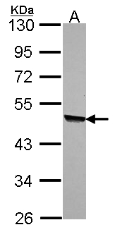 KYNU Antibody - Sample (30 ug of whole cell lysate). A: A549. 10% SDS PAGE. KYNU antibody diluted at 1:1000.