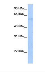 KYNU Antibody - 721_B cell lysate. Antibody concentration: 0.5 ug/ml. Gel concentration: 12%.  This image was taken for the unconjugated form of this product. Other forms have not been tested.