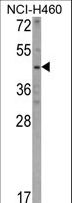 KYNU Antibody - Western blot of KYNU Antibody in NCI-H460 cell line lysates (35 ug/lane). KYNU (arrow) was detected using the purified antibody.