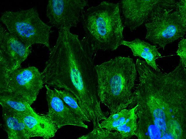 KYNU Antibody - Immunofluorescence staining of KYNU in A549 cells. Cells were fixed with 4% PFA, permeabilzed with 0.1% Triton X-100 in PBS, blocked with 10% serum, and incubated with rabbit anti-human KYNU monoclonal antibody (dilution ratio 1:60) at 4°C overnight. Then cells were stained with the Alexa Fluor 488-conjugated Goat Anti-rabbit IgG secondary antibody (green) and counterstained with DAPI (blue). Positive staining was localized to Cytoplasm.