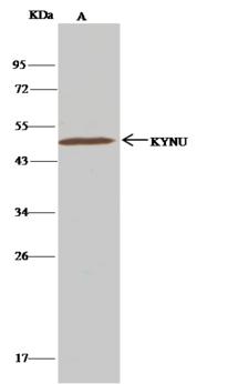 KYNU Antibody - KYNU-HIS was immunoprecipitated using: Lane A: 0.5 mg A549 Whole Cell Lysate. 0.5 uL anti-KYNU-HIS rabbit monoclonal antibody and 15 ul of 50% Protein G agarose. Primary antibody: Anti-KYNU-HIS rabbit monoclonal antibody, at 1:500 dilution. Secondary antibody: Clean-Blot IP Detection Reagent (HRP) at 1:1000 dilution. Developed using the DAB staining technique. Performed under reducing conditions. Predicted band size: 52 kDa. Observed band size: 52 kDa.