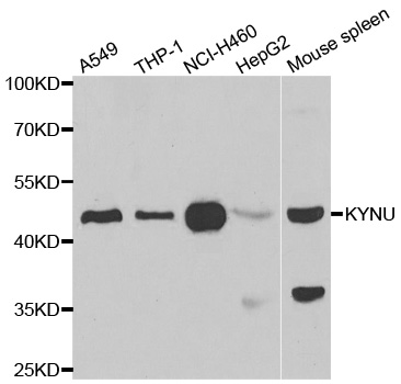 KYNU Antibody - Western blot analysis of extracts of various cell lines.