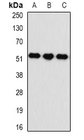 KYNU Antibody - Western blot analysis of Kynureninase expression in A549 (A); HepG2 (B); mouse spleen (C) whole cell lysates.