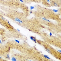 KYNU Antibody - Immunohistochemical analysis of Kynureninase staining in mouse heart formalin fixed paraffin embedded tissue section. The section was pre-treated using heat mediated antigen retrieval with sodium citrate buffer (pH 6.0). The section was then incubated with the antibody at room temperature and detected using an HRP conjugated compact polymer system. DAB was used as the chromogen. The section was then counterstained with hematoxylin and mounted with DPX.