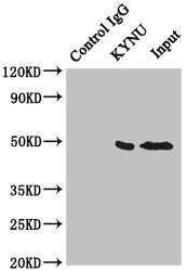 KYNU Antibody - Immunoprecipitating KYNU in HeLa whole cell lysate Lane 1: Rabbit monoclonal IgG(1ug) instead of product in HeLa whole cell lysate.For western blotting, a HRP-conjugated anti-rabbit IgG, specific to the non-reduced form of IgG was used as the Secondary antibody (1/50000) Lane 2: product(4ug)+ HeLa whole cell lysate(500ug) Lane 3: HeLa whole cell lysate (20ug)