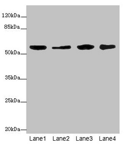 KYNU Antibody - Western blot All Lanes: KYNUantibody at 3.26ug/ml Lane 1 : A549 whole cell lysate Lane 2 : HepG-2 whole cell lysate Lane 3 : Thp-1 whole cell lysate Lane 4 : Hela whole cell lysate Secondary Goat polyclonal to Rabbit IgG at 1/10000 dilution Predicted band size: 53,35 kDa Observed band size: 52 kDa