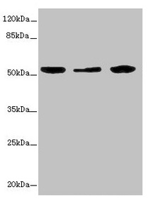 KYNU Antibody - Western blot All lanes: KYNU antibody at 3.26µg/ml Lane 1: A549 whole cell lysate Lane 2: HepG2 whole cell lysate Lane 3: THP-1 whole cell lysate Secondary Goat polyclonal to rabbit IgG at 1/10000 dilution Predicted band size: 53, 35 kDa Observed band size: 53 kDa