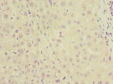 KYNU Antibody - Immunohistochemistry of paraffin-embedded human liver tissue at dilution 1:100