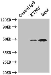 KYNU Antibody - Immunoprecipitating KYNU in HeLa whole cell lysate Lane 1: Rabbit monoclonal IgG(1ug) instead of product in HeLa whole cell lysate.For western blotting, a HRP-conjugated anti-rabbit IgG, specific to the non-reduced form of IgG was used as the Secondary antibody (1/50000) Lane 2: product(4ug)+ HeLa whole cell lysate(500ug) Lane 3: HeLa whole cell lysate (20ug)