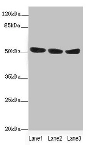 KYNU Antibody - Western blot All Lanes: KYNUantibody at 1.44ug/ml Lane 1 : A549 whole cell lysate Lane 2 : HepG-2 whole cell lysate Lane 3 : Hela whole cell lysate Secondary Goat polyclonal to Rabbit IgG at 1/10000 dilution Predicted band size: 53,35 kDa Observed band size: 52 kDa