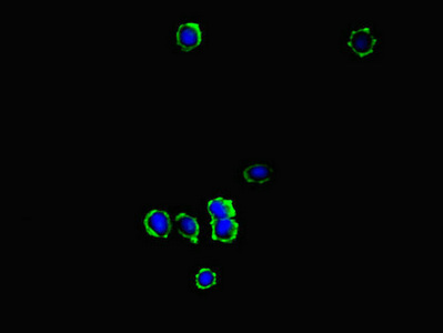 KYNU Antibody - Immunofluorescent analysis of mcf-7 cells diluted at 1:100 and Alexa Fluor 488-congugated AffiniPure Goat Anti-Rabbit IgG(H+L)