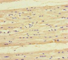 KYNU Antibody - Immunohistochemistry of paraffin-embedded human heart tissue at dilution of 1:100