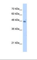 KYNU Antibody - HepG2 cell lysate. Antibody concentration: 5.0 ug/ml. Gel concentration: 12%.  This image was taken for the unconjugated form of this product. Other forms have not been tested.