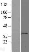 KYNU Protein - Western validation with an anti-DDK antibody * L: Control HEK293 lysate R: Over-expression lysate