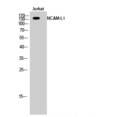 L1CAM Antibody - Western blot of NCAM-L1 antibody