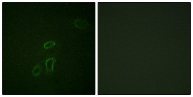 L1CAM Antibody - Immunofluorescence analysis of HepG2 cells, using CD171/N-CAML1 Antibody. The picture on the right is blocked with the synthesized peptide.