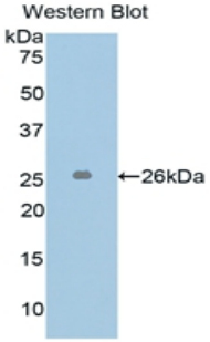 L1CAM Antibody - Western blot of recombinant L1CAM.  This image was taken for the unconjugated form of this product. Other forms have not been tested.