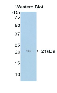 L1CAM Antibody - Western blot of recombinant L1CAM.  This image was taken for the unconjugated form of this product. Other forms have not been tested.