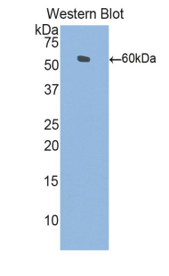 L1CAM Antibody - Western blot of recombinant L1CAM.  This image was taken for the unconjugated form of this product. Other forms have not been tested.