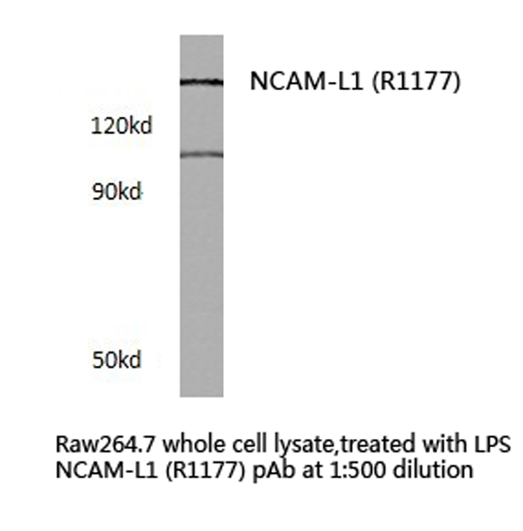 L1CAM Antibody - Western blot of NCAM-L1 (R1177) pAb in extracts from Raw264.7 cells treated with LPS.