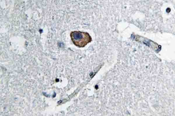 L1CAM Antibody - IHC of NCAM-L1 (R1177) pAb in paraffin-embedded human brain tissue.