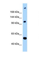L1CAM Antibody - L1CAM antibody Western blot of Fetal Brain lysate. Antibody concentration 1 ug/ml.  This image was taken for the unconjugated form of this product. Other forms have not been tested.