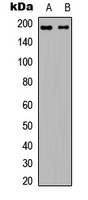 L1CAM Antibody - Western blot analysis of L1CAM expression in Jurkat (A); Raw264.7 (B) whole cell lysates.