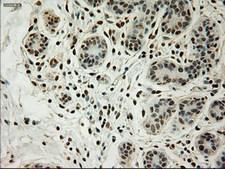 L1CAM Antibody - IHC of paraffin-embedded breast tissue using anti-L1CAM mouse monoclonal antibody. (Dilution 1:50).