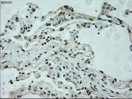 L1CAM Antibody - IHC of paraffin-embedded lung tissue using anti-L1CAM mouse monoclonal antibody. (Dilution 1:50).