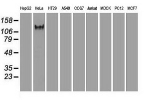 L1CAM Antibody - Western blot of 35 ug of cell extracts from human (HeLa) cells using anti-L1CAM antibody.